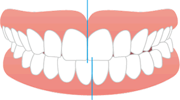 画像：正中の不一致